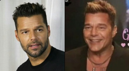 Ricky Martin se dio una manita de gato en la cara y lo destrozan en redes sociales