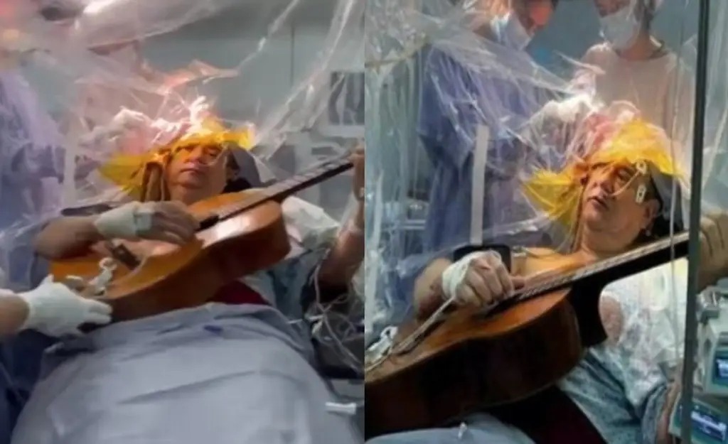 Le extirpan tumor cerebral mientras toca la guitarra